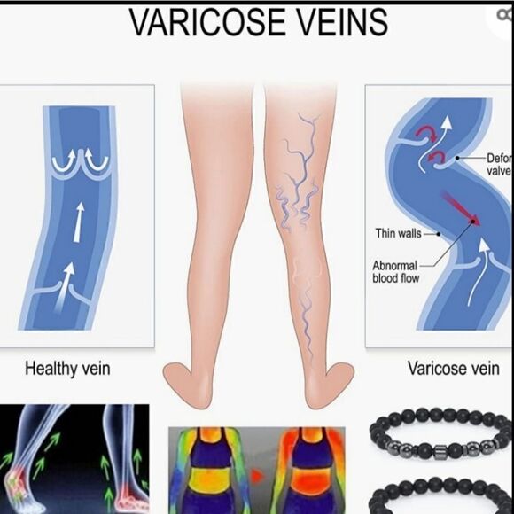 Anti swelling black obsidian stretch stone bracelet. - Picture 5 of 8